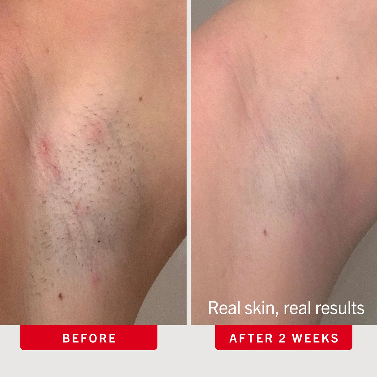 Sovara™ – 2-Step Smoothing Duo