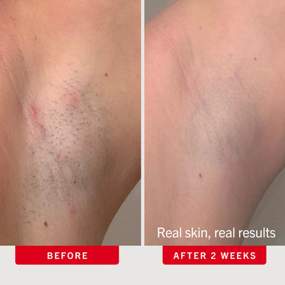 Sovara™ – 2-Step Smoothing Duo