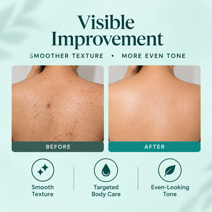 Clarévia™ – Mandelic Acid Serum